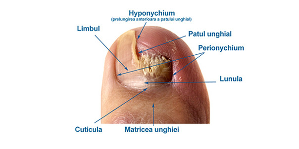 Onicomicoza