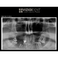 Viziodent by Dental Alex - poza