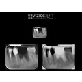 Viziodent by Dental Alex - poza