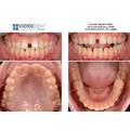 Viziodent by Dental Alex - poza