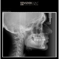 Viziodent by Dental Alex - poza